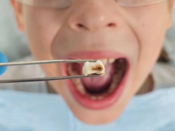 Best Cracked Tooth Emergency Dentist  in Mount Holly, NC