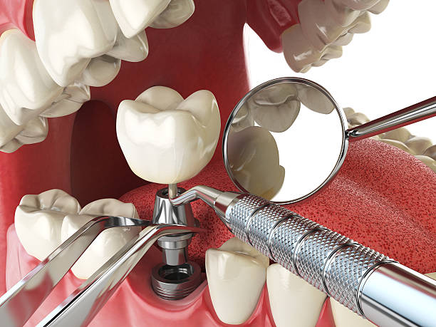 Best Cracked Tooth Emergency Dentist  in Mount Holly, NC